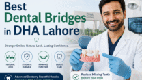 Best Dental Bridges in DHA Lahore for Strong Teeth