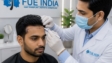 Hair Transplant Before and After