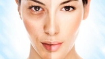 Morpheus 8 for Acne Scars: Dubai’s Latest Solution for Clearer Skin